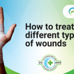 How to treat different types of wounds - AITS